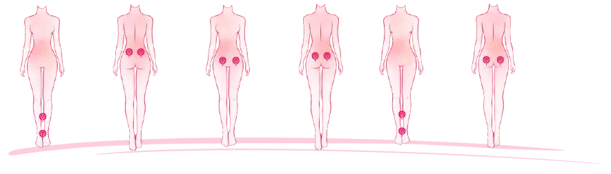 Endométriose : la neurostimulation transcutanée pour soulager les douleurs pelviennes chroniques, accompagnement personnalisé.